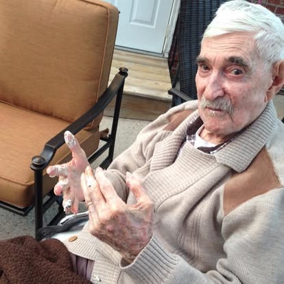 A resident showing off marshmallow-covered fingers after roasting at the fire pit